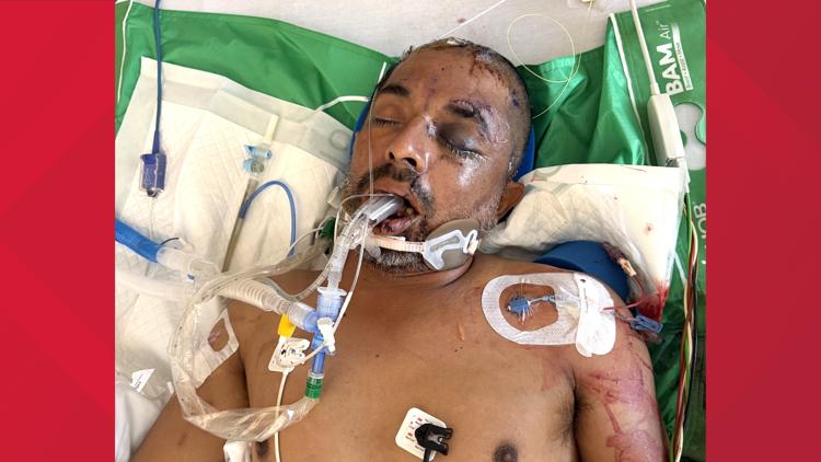University Hospital asks for help identifying unconscious patient hit by truck Saturday evening — KENS 5 (San Antonio), Belvedere Health news